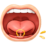 dính thắng lưỡi