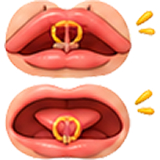 dính thắng môi