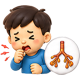 viêm phế quản